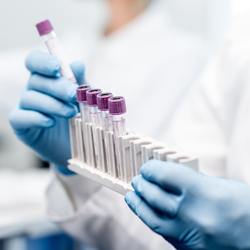 Lab testing that goes beyond the numbers, helping you understand what’s happening in your body and guide your care.<br> <a href="https://rhibackup.workwithmajorfluke.com/services/laboratory-services/" class="single-btn">Learn More</a>